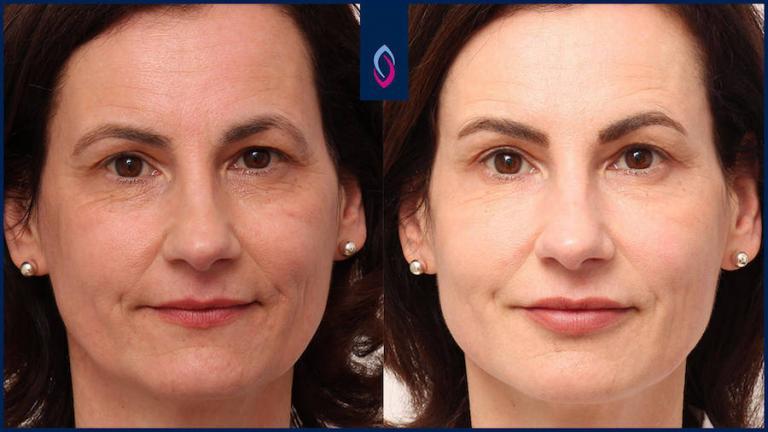 Das Konzept Des Facial Design Von Avesina