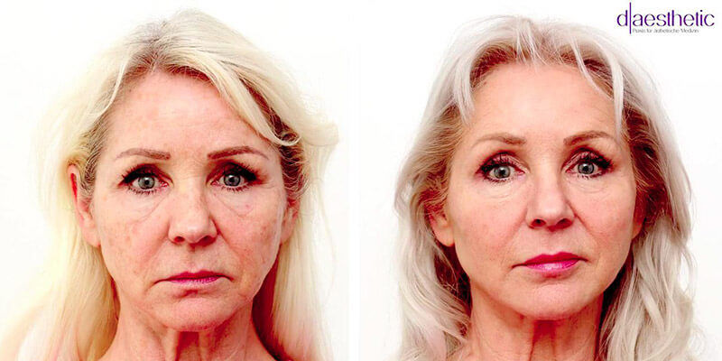 Was ist Facial Design?